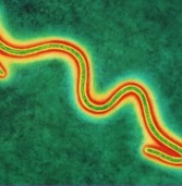 România: Pacientul suspectat de Ebola nu are virusul ucigător