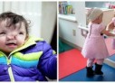 VIDEO: O nouă față pentru o fetiță de doi ani din SUA